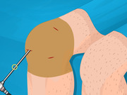 Knie-operatie